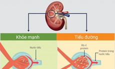 Ngăn ngừa biến chứng thận do đái tháo đường