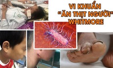 Cảnh giác với bệnh do vi khuẩn Whitmore gây ra sau lũ lụt