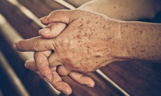 Các bệnh ngoài da thường gặp ở người cao tuổi