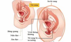 Sa sinh dục, bệnh khó nói...