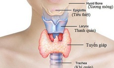 Bài thuốc hỗ trợ trị cường giáp