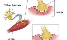 Cẩn trọng kẻo bị nhược cơ