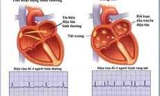 Nhiều đột phá trong ứng dụng điều trị các bệnh tim mạch