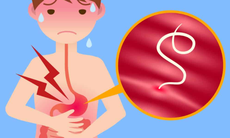 Phòng nhiễm giun móc ở trẻ