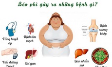 Những bệnh người béo phì dễ mắc