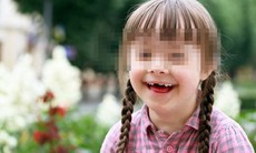 Bé mắc hội chứng Down, có phòng được không?