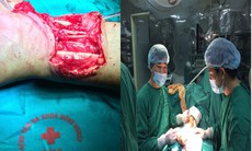 Những ca mổ trắng đêm của bác sĩ ngoại chấn thương