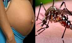 4 điều phụ nữ mang thai cần làm để phòng ngừa Zika