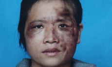 Vợ tố bị chồng bạo hành dã man vì bán hàng đa cấp mất tiền