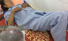 Tin lời thầy bói phán có thai, người phụ nữ mang khối u 10kg suốt 9 tháng