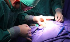 Phẫu thuật tạo hình hậu môn cho trẻ sơ sinh chưa đầy một ngày tuổi