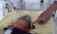 3 cuộc gọi đường dây nóng phản ánh vết chỉ khâu trên đầu trẻ sơ sinh