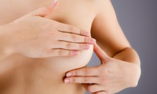 Những điều cần biết về u xơ tuyến vú