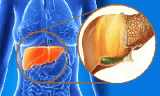 Gan nhiễm mỡ - bệnh phổ biến nhưng khó phát hiện