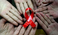 UNAIDS: Số ca tử vong do HIV giảm