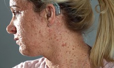 Căn bệnh lạ khiến người phụ nữ không dám ra khỏi nhà