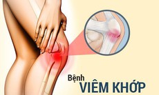 Thuốc ức chế TNF trị viêm khớp làm tăng nhu cầu dùng thuốc giảm đau opiod