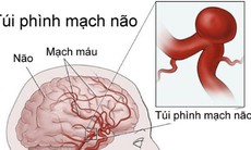 Nguy cơ phình mạch máu do sử dụng thuốc ung thư