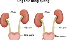 Dấu hiệu nhận biết ung thư bàng quang