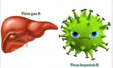 Hỗ trợ điều trị viêm gan bằng y học cổ truyền