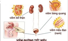 Bấm huyệt trị liệu tiểu tiện không kiểm soát