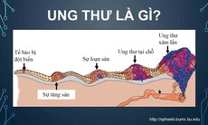 Từ thông tin diễn viên Mai Phương bị K phổi, hãy tìm hiểu về ung thư qua góc nhìn bác sĩ chuyên khoa