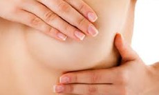Thấy đau tức ngực, đến bệnh viện khám người phụ nữ phát hiện bị K vú