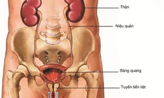 Nguy cơ nhiễm khuẩn tiết niệu tại  bệnh viện