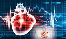  Những dấu hiệu sớm cảnh báo nhồi máu cơ tim