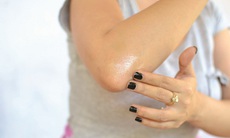 Cotison, hydrocortison: Những chú ý về công dụng, cách dùng