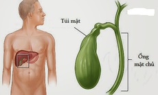 Khi nào nên cắt túi mật?