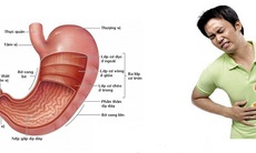 Viêm dạ dày cấp: Hãy yên tâm, chữa khỏi