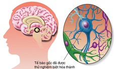 Tế bào gốc ứng dụng trong y học