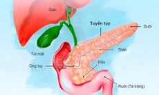 Tụy nhân tạo: Hy vọng mới cho bệnh nhân đái tháo đường týp 1