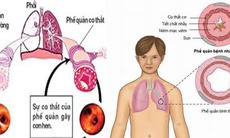 Ðề phòng tác dụng phụ của thuốc giãn phế quản