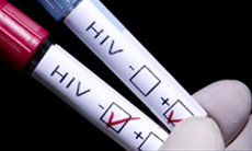 Xét nghiệm HIV