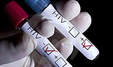 Các liệu pháp điều trị HIV mới: Tăng thêm 10 năm tuổi thọ cho người bệnh