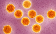 Viêm gan siêu vi A có thể gây dịch và tử vong do suy gan cấp!