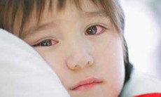 Đau mắt đỏ, đừng tự chữa  khiến bệnh lành tính bị biến chứng nặng