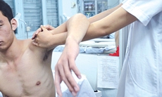 Xoa bóp - bấm huyệt điều trị cơ nhị đầu cánh tay