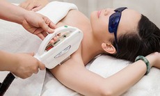 Tác dụng không mong muốn do triệt lông bằng laser