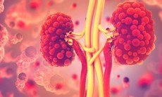 Thận đa nang gây nhiều biến chứng nguy hiểm