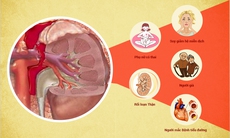 Bệnh thận - tiết niệu: Có thể phòng ngừa?