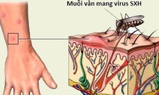 Chớ chủ quan với sốt xuất huyết