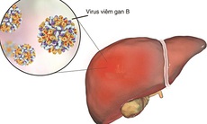 Chẩn đoán và điều trị viêm gan B theo hướng dẫn mới nhất của Bộ Y tế