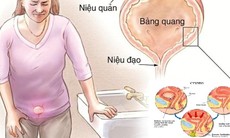 Nhận biết, xử trí nhiễm trùng tiết niệu ở người cao tuổi