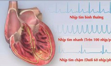 Dược thiện trị chứng tâm hỏa thịnh