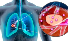 Nanomedicine và hàng rào sinh học của cơ thể