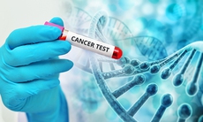 Xét nghiệm di truyền giúp phụ nữ mắc ung thư vú tránh phải hóa trị liệu
