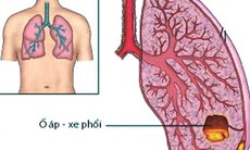 Hoa phù dung thanh nhiệt, giải độc